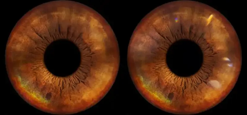 Cómo fotografiar tu propio ojo