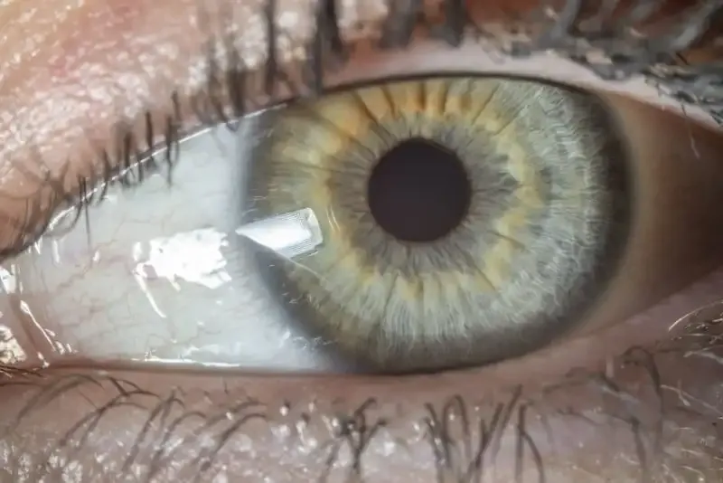 El diafragma en la fotografía: Una guía completa